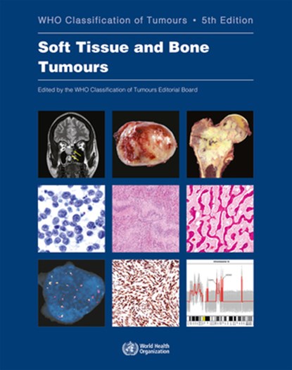 WHO classification of tumours of soft tissue and bone tumours, International Agency for Research on Cancer ; World Health Organization ; International Academy of Pathology - Paperback - 9789283245025