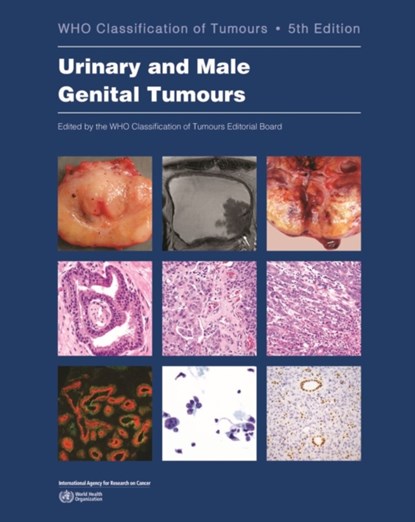 URINARY & MALE GENITAL TUMOURS, Who Classification of Tumours Editorial - Paperback - 9789283245124