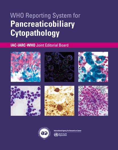 Who Reporting System for Pancreaticobiliary Cytopathology, Iac-Iarc-Who Joint Editorial Board - Paperback - 9789283245186
