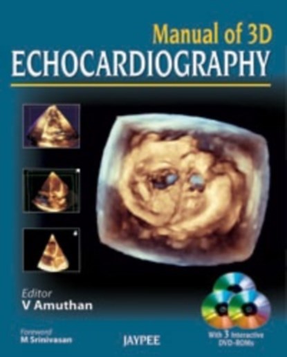 Manual of 3D Echocardiography, V Amuthan - Gebonden - 9789350255865