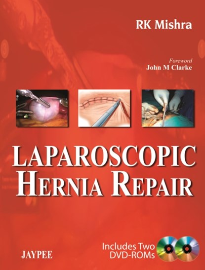 Laparoscopic Hernia Repair, RK Mishra - Gebonden - 9789350258729
