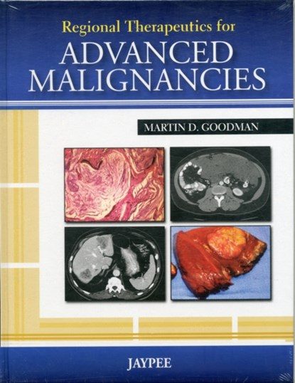 Regional Therapeutics for Advanced Malignancies, Martin Goodman - Gebonden - 9789350258873