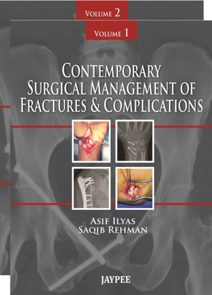 Contemporary Surgical Management of Fractures and Complications, Asif Ilyas ; Saqib Rehman - Gebonden - 9789350259641