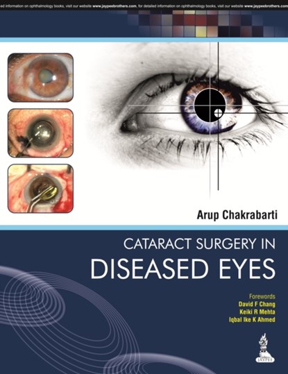 Cataract Surgery in Diseased Eyes, Arup Chakrabarti - Gebonden - 9789351520924
