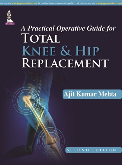 A Practical Operative Guide for Total Knee and Hip Replacement, Ajit Kumar Mehta - Gebonden - 9789351524823