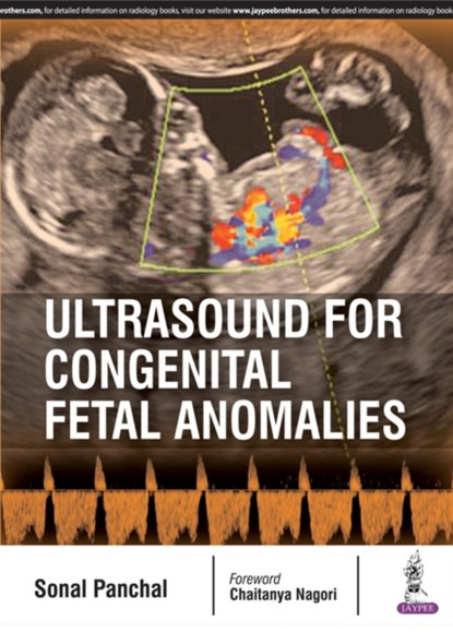 Ultrasound for Congenital Fetal Anomalies, Sonal Panchal - Paperback - 9789352700882