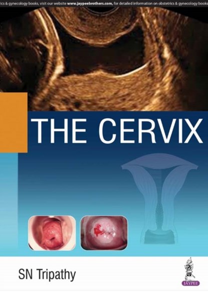 The Cervix, SN Tripathy - Gebonden - 9789352702091