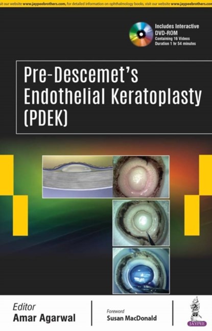Pre-Descemet's Endothelial Keratoplasty (PDEK), Amar Agarwal - Gebonden - 9789352703036