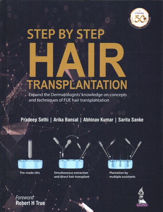 Step by Step Hair Transplantation