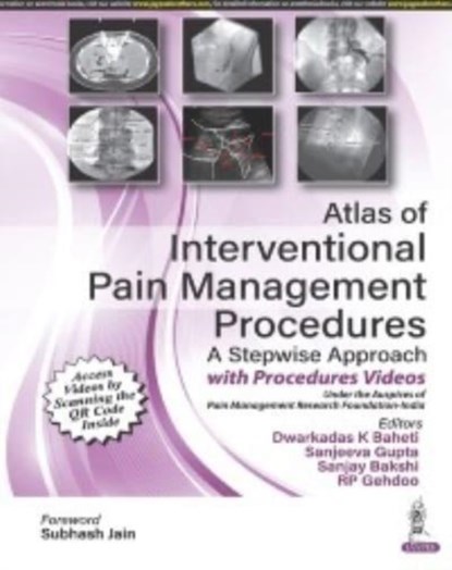 Atlas of Interventional Pain Management Procedures, Dwarkadas K Baheti ; Sanjeeva Gupta ; Sanjay Bakshi ; RP Gehdoo - Gebonden - 9789354655470