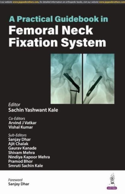 A Practical Guidebook in Femoral Neck Fixation System, Sachin Yashwant Kale ; Arvind J Vatkar ; Vishal Kumar - Paperback - 9789356965959