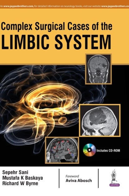 Complex Surgical Cases of the Limbic System, Sepehr Sani ; Mustafa K Baskaya ; Richard W Byrne - Gebonden - 9789386261441