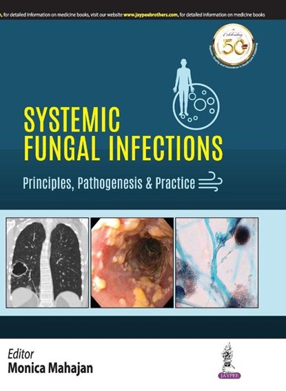 Systemic Fungal Infections: Principles, Pathogenesis & Practice, Monica Mahajan - Paperback - 9789389188349