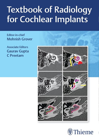 Textbook of Radiology for Cochlear Implants, Mohnish Grover - Gebonden - 9789392819261