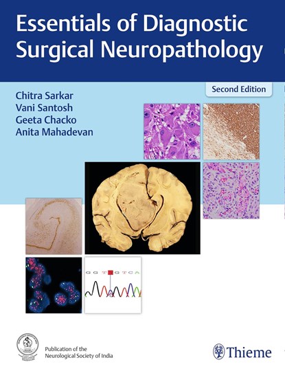 Essentials of Diagnostic Surgical Neuropathology, Chitra Sarkar ; Vani Santosh ; Geeta Chacko ; Anita Mahadevan - Gebonden - 9789395390057