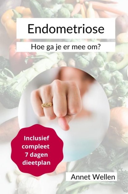 Endometriose, Annet Wellen - Ebook - 9789403650579