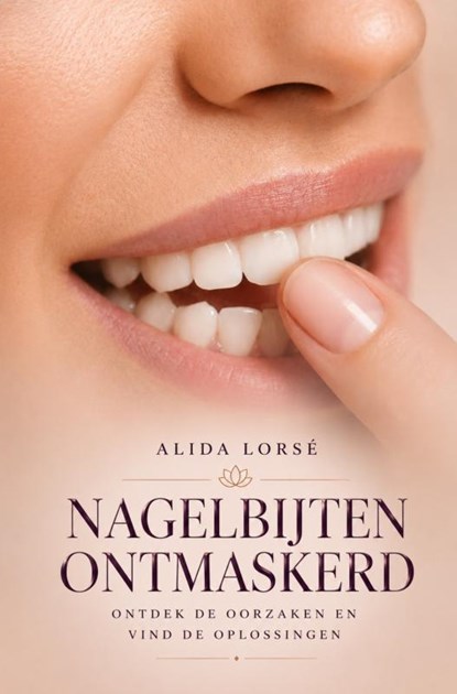 Nagelbijten Ontmaskerd, Alida Lorsé - Paperback - 9789403751610