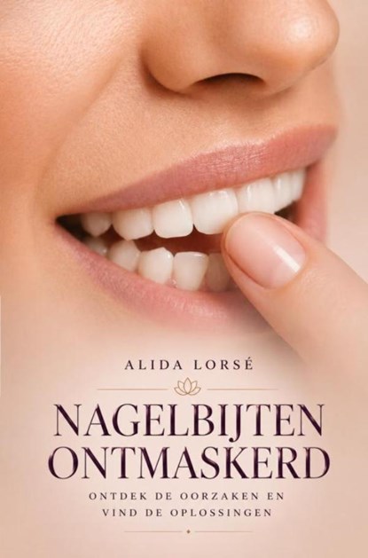 Nagelbijten ontmaskerd, Alida Lorsé - Ebook - 9789403751719