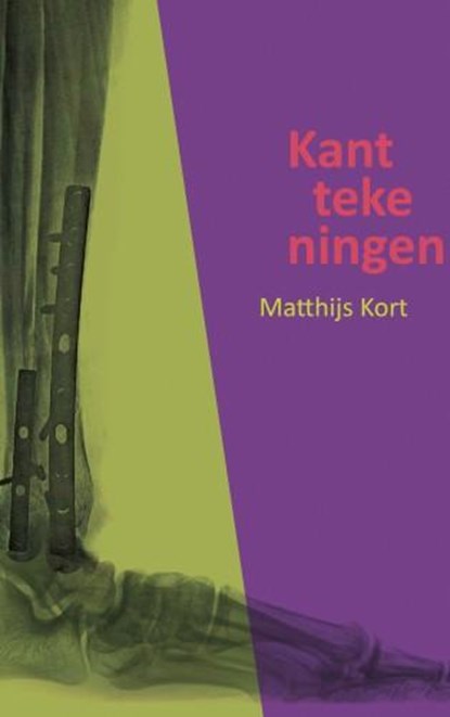 Kanttekeningen, Matthijs Kort - Paperback - 9789461936288
