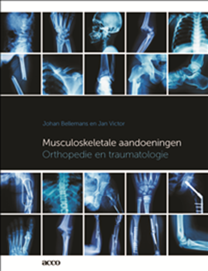 Musculoskeletale aandoeningen, Johan Bellemans ; Jan Victor - Paperback - 9789463443890