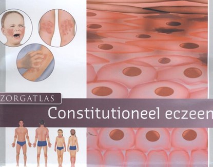 Zorgatlas constitutioneel eczeem, Rob Beljaards - Gebonden - 9789491984433
