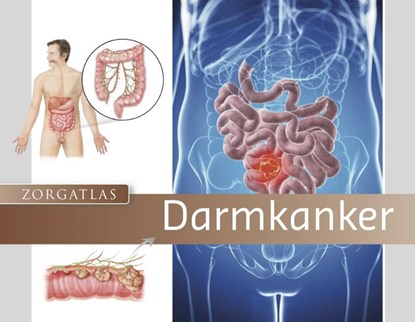 Zorgatlas Darmkanker, Riëtte Ruijten-Driessen ; Simone Dokter ; Dianne Backelandt - Gebonden - 9789491984471