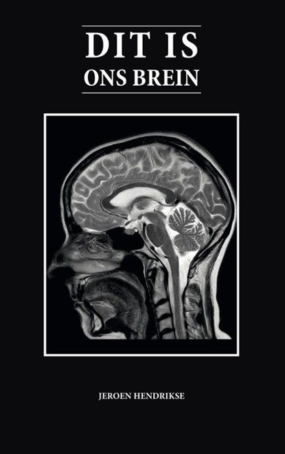 Dit is ons brein, Jeroen Hendrikse - Paperback - 9789492284006