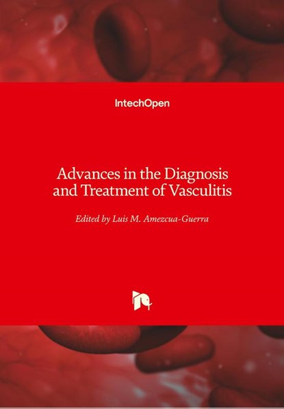 Advances in the Diagnosis and Treatment of Vasculitis, Luis M. Amezcua-Guerra - Gebonden - 9789533077864