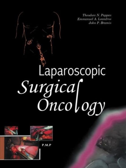 Laparoscopic Surgical Oncology, Theodore Pappas ; Emmanuel Leandros ; John Bramis - Gebonden - 9789603993377