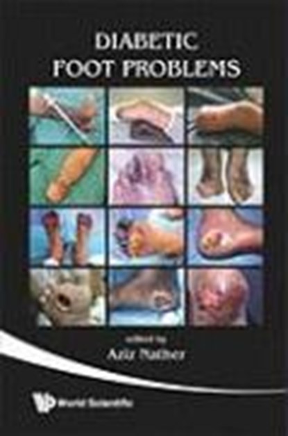 Diabetic Foot Problems, ABDUL AZIZ (NATIONAL UNIV HEALTH SYSTEM,  S'pore) Nather - Paperback - 9789812791528