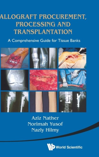 Allograft Procurement, Processing And Transplantation: A Comprehensive Guide For Tissue Banks, ABDUL AZIZ (NATIONAL UNIV HEALTH SYSTEM,  S'pore) Nather - Gebonden - 9789814291187