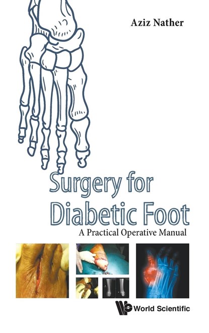 Surgery For Diabetic Foot: A Practical Operative Manual, ABDUL AZIZ (NATIONAL UNIV HEALTH SYSTEM,  S'pore) Nather - Gebonden - 9789814759830