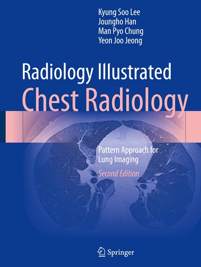 Radiology Illustrated: Chest Radiology, Kyung Soo Lee ;  Yeon Joo Jeong ;  Man Pyo Chung ;  Joungho Han - Gebonden - 9789819966325