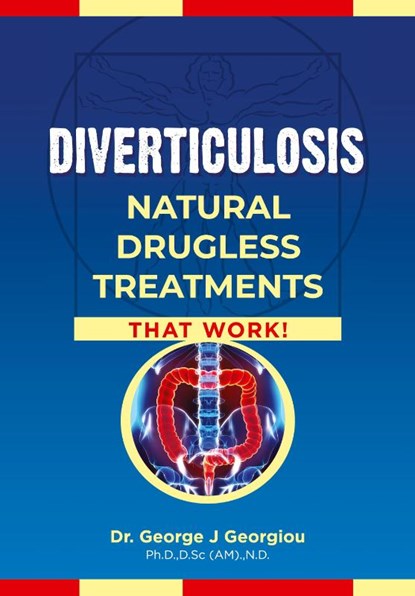 Diverticulosis, George John Georgiou - Paperback - 9789925569182