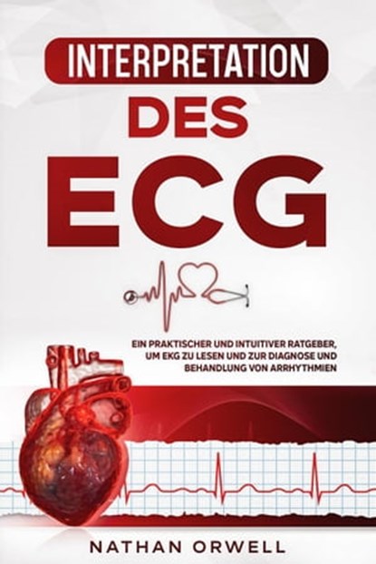 Interpretation des EKG: Ein praktischer und intuitiver Ratgeber, um EKG zu lesen und zur Diagnose und Behandlung von Arrhythmien, Nathan Orwell - Ebook - 9798201042233