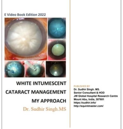 White Intumescent Cataract Management: My Approach, Sudhir Singh - Ebook - 9798201376215