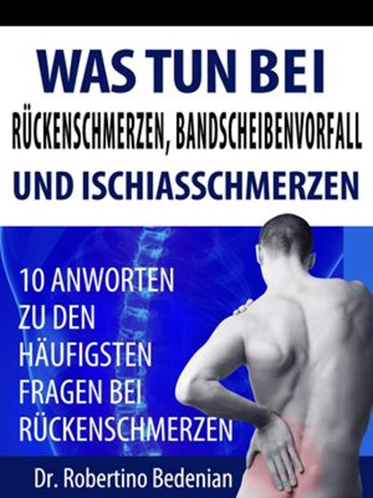 Was Tun Bei Rückenschmerzen, Bandscheibenvorfall Und Ischiasschmerzen: 10 Antworten Zu Den Häufigsten Fragen Bei Rückenschmerzen, Dr. Robertino Bedenian - Ebook - 9798201846190