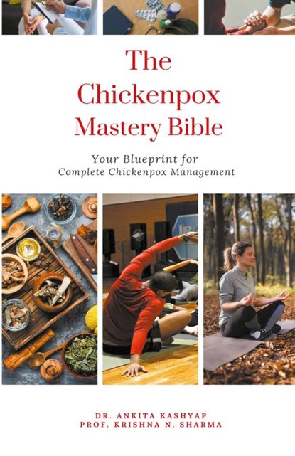 The Chickenpox Mastery Bible, Ankita Kashyap ; Krishna N. Sharma - Paperback - 9798223123071