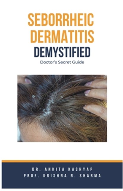 Seborrheic Dermatitis Demystified: Doctor's Secret Guide, Ankita Kashyap - Paperback - 9798223195948