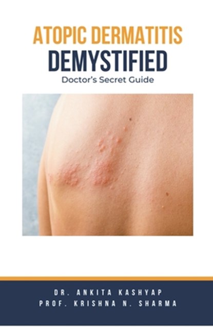 Atopic Dermatitis Demystified: Doctor's Secret Guide, Ankita Kashyap - Paperback - 9798223498339