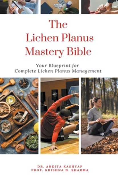 The Lichen Planus Mastery Bible, Ankita Kashyap ;  Krishna N. Sharma - Paperback - 9798223696940