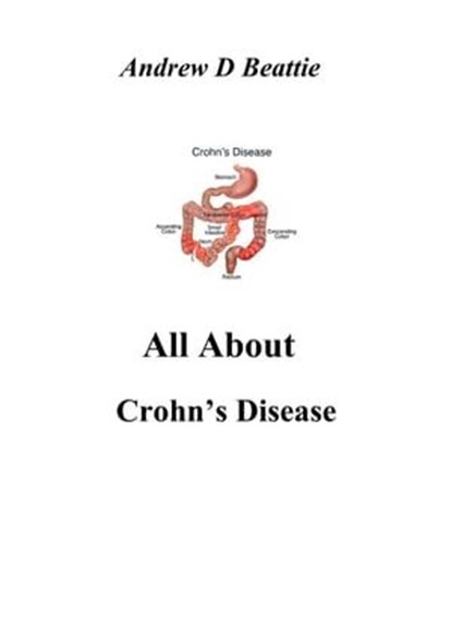 All About Crohn's Disease, Andrew D Beattie - Ebook - 9798223743446