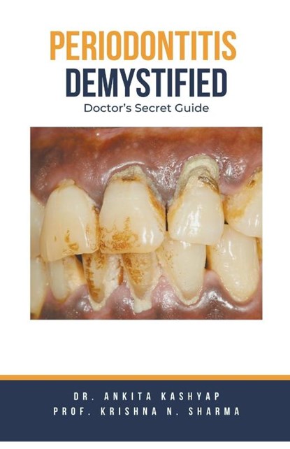 Periodontitis Demystified, Ankita Kashyap ; Krishna N. Sharma - Paperback - 9798223858218