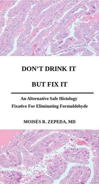 Don't Drink It But Fix It: An Alternative Safe Histology Fixative For Eliminating Formaldehyde, Moisés Zepeda - Ebook - 9798224768929