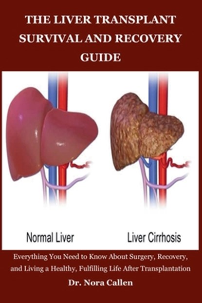 The Liver Transplant Survival and Recovery Guide: Everything You Need to Know About Surgery, Recovery, and Living a Healthy, Fulfilling Life After Tra, Nora Callen - Paperback - 9798270102883