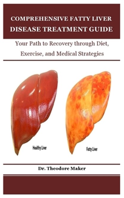 Comprehensive Fatty Liver Disease Treatment Guide: Your Path to Recovery through Diet, Exercise, and Medical Strategies, Theodore Maker - Paperback - 9798307482865