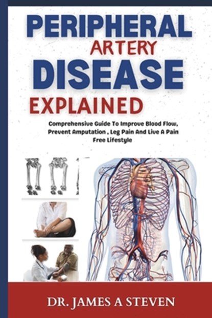peripheral Artery Disease Explained: Comprehensive Guide To Improve Blood Flow, Prevent Amputation, Leg Pain And Live A Pain Free Lifestyle, James A. Steven - Paperback - 9798311455947