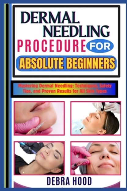 Dermal Needling Procedure: Mastering Dermal Needling: Techniques, Safety Tips, and Proven Results for All Skin Types, Debra Hood - Paperback - 9798312535990