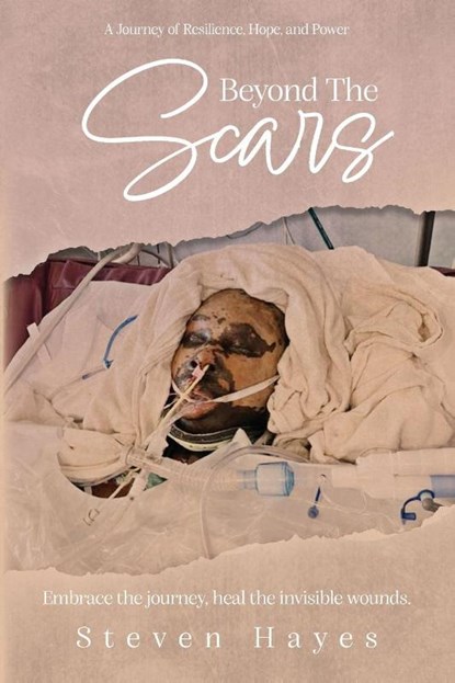 Beyond The Scars, Steven Hayes - Paperback - 9798318805400