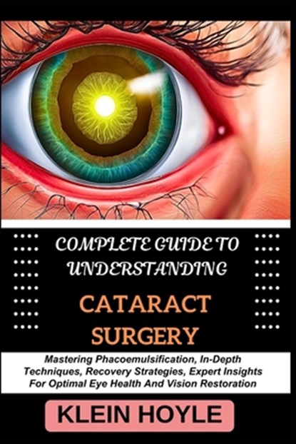 Complete Guide to Understanding Cataract Surgery: Mastering Phacoemulsification, In-Depth Techniques, Recovery Strategies, Expert Insights For Optimal, Klein Hoyle - Paperback - 9798328821346